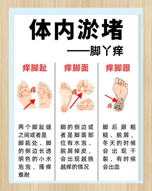 脚腿皮肤痒,究竟是什么原因在作祟?