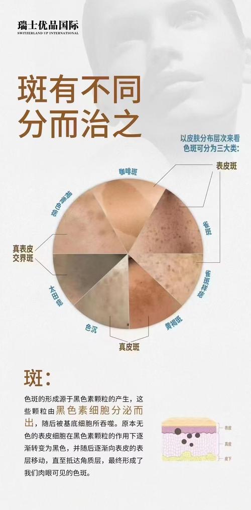 皮肤干长斑是身体缺信号吗?