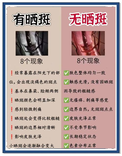 皮肤干长斑是身体缺信号吗?