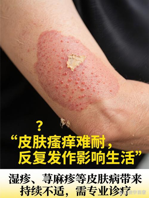 沈阳哪家皮肤病看的好