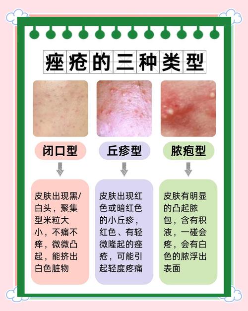 面部皮肤有炎症怎么办