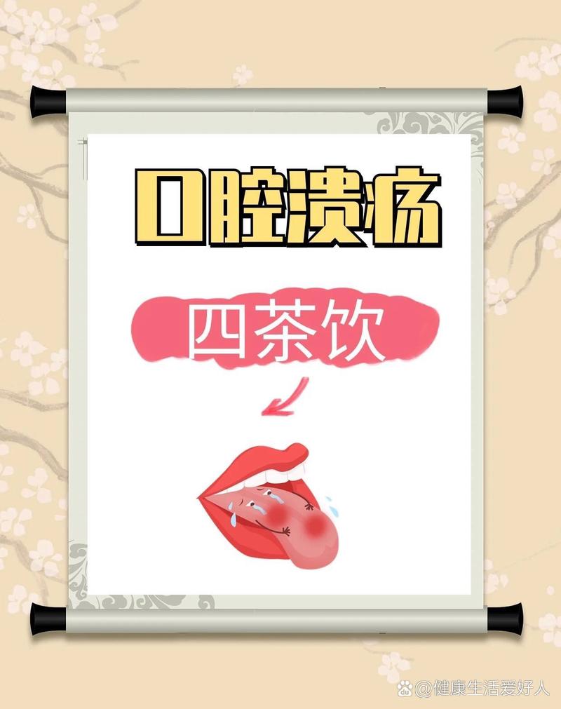 口腔溃疡喝什么茶能快速去火?