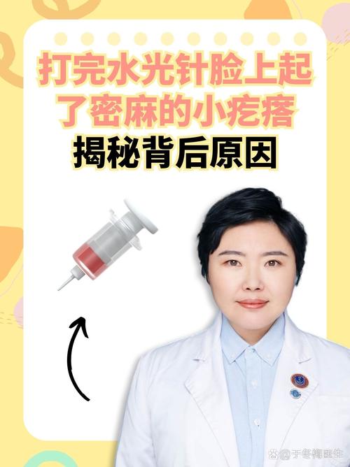 皮肤过敏能打水光针吗