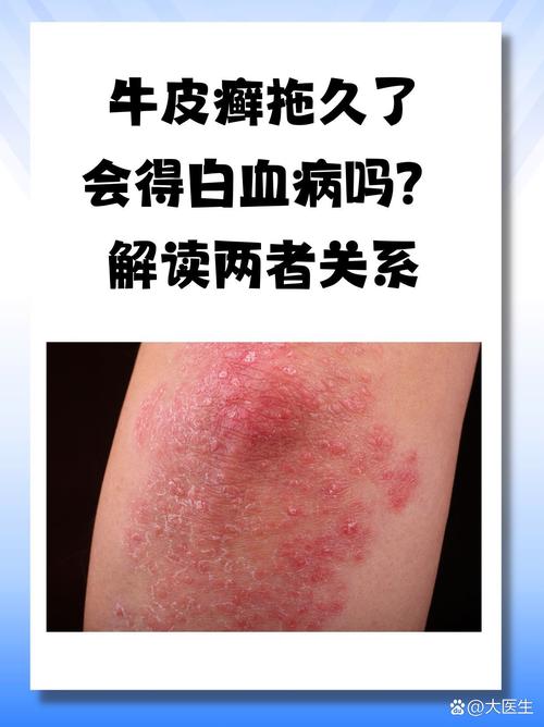 皮肤病跟血液有关系吗