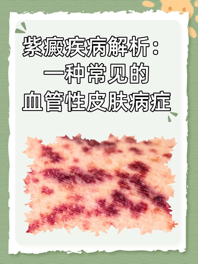 皮肤病跟血液有关系吗