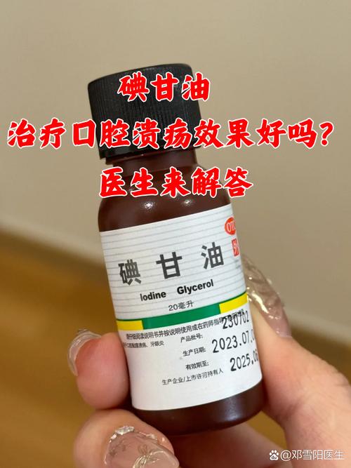 碘甘油用后口腔更严重,是正常反应还是用错了?