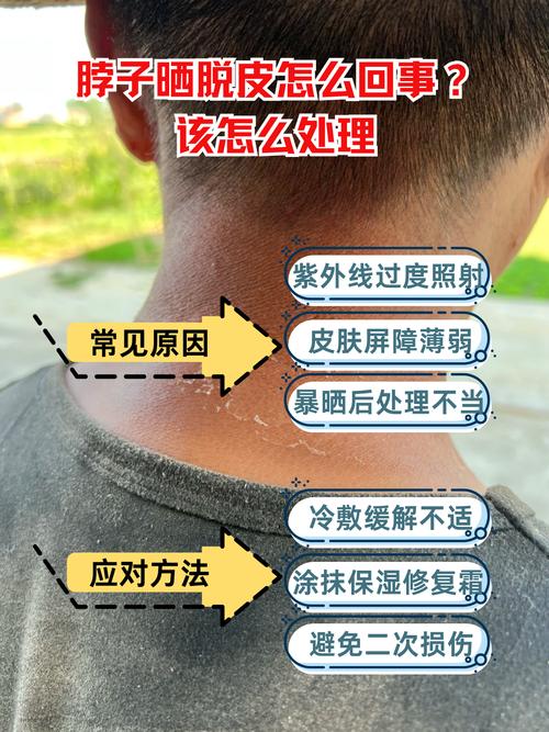 晒伤的皮肤为什么会痒