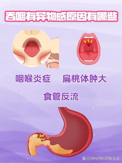 口腔有异物是什么原因