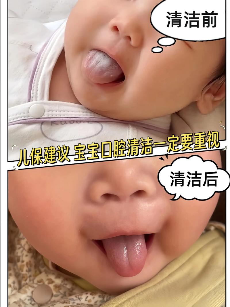新生儿口腔需清洁吗?