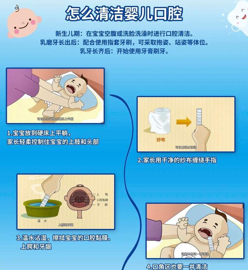新生儿口腔需清洁吗?