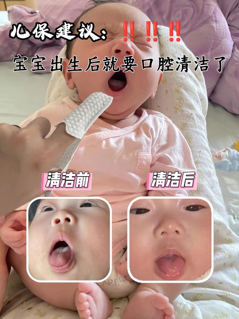 新生儿口腔需清洁吗?
