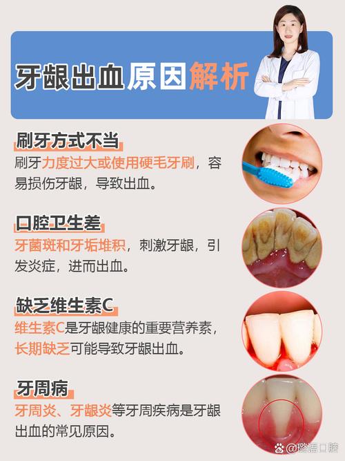 早上口腔出血是啥原因?