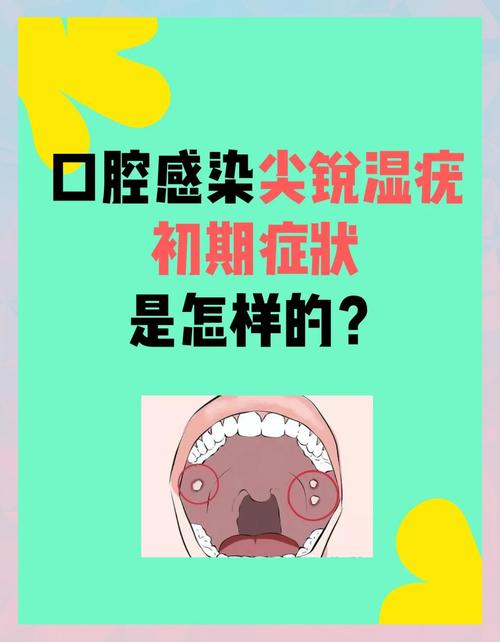 口腔尖锐湿尤怎么治疗