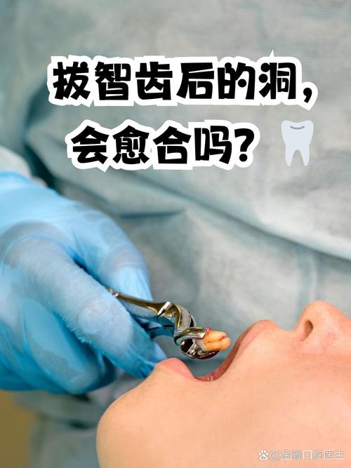 口腔诊所都能拔智齿吗?