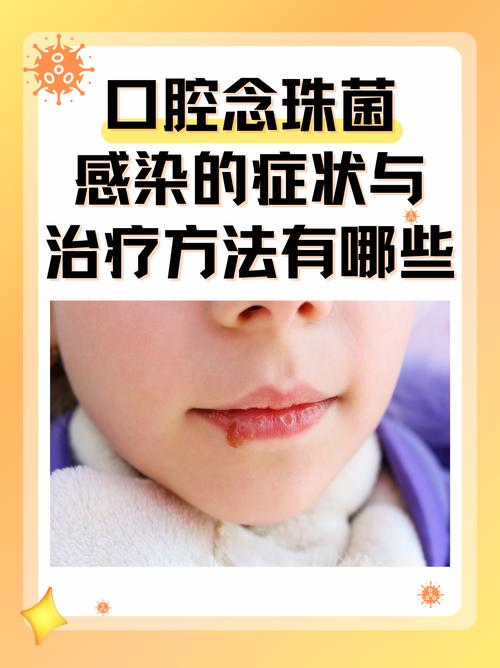 儿童口腔溃疡该挂哪科?