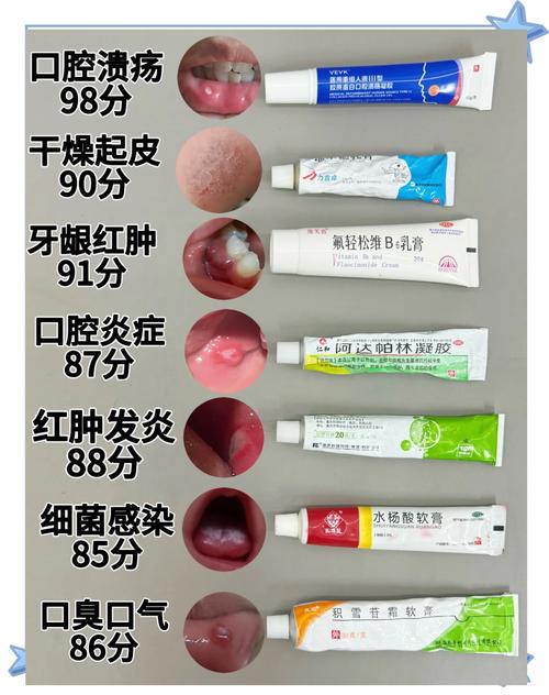 儿童口腔溃疡该挂哪科?