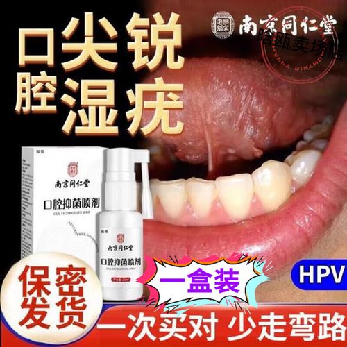 鹅口疮用什么药涂口腔