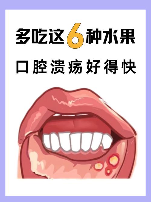 口腔溃疡吃苦瓜会加重疼痛吗?