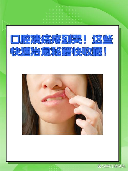 口腔溃疡怎么好得快?