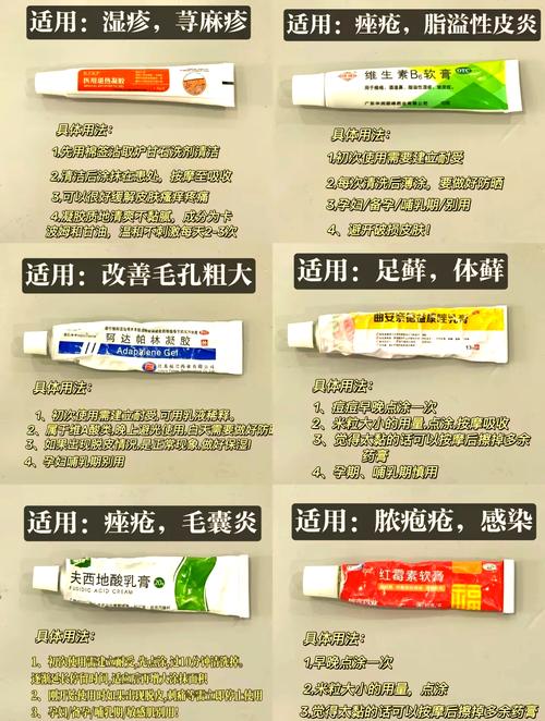 皮肤药膏药名大全图片,哪种最对症?
