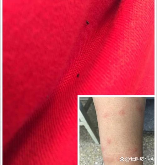 敌敌畏皮肤中毒如何紧急处理?