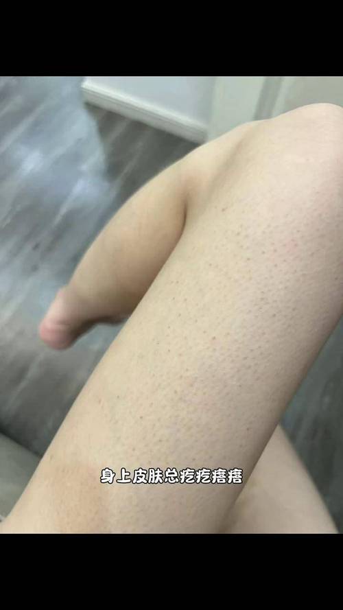 搓澡搓伤皮肤火辣疼痛,为何会这样?