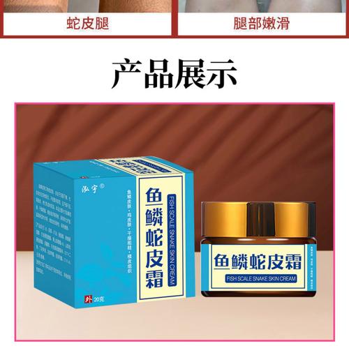 鱼鳞皮肤用药膏选哪种好?