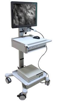 皮肤CT能查清哪些皮肤问题?