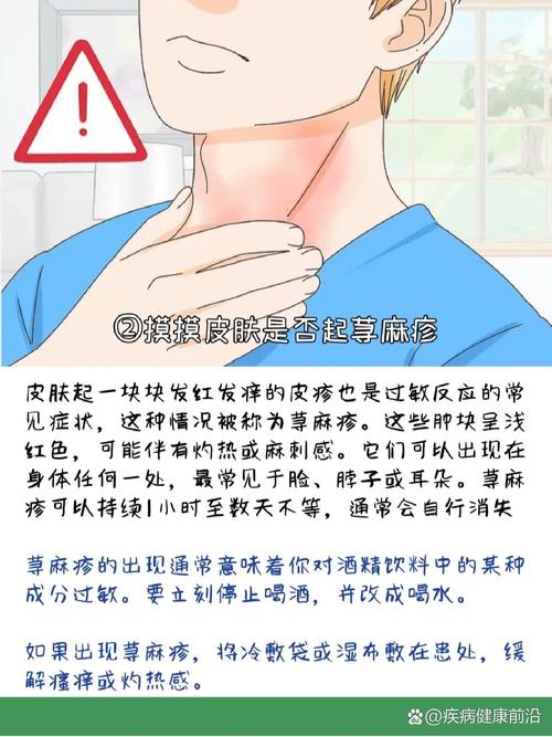 皮肤痒可以用酒精擦吗