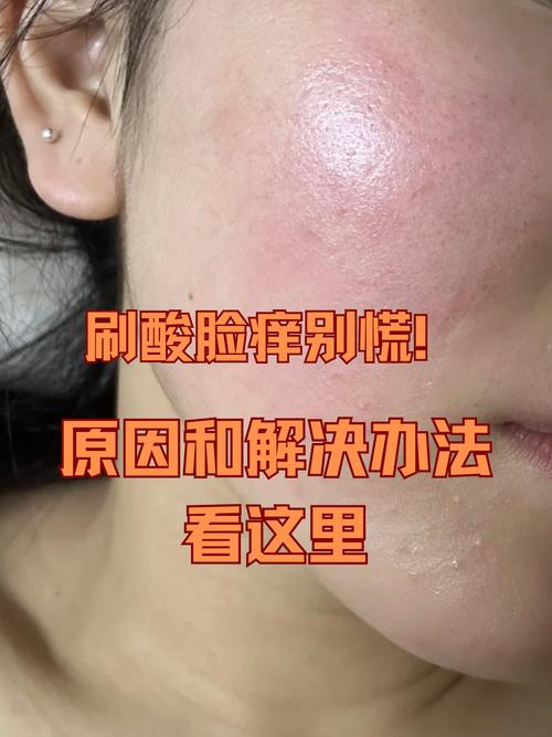 脸部干痒红,急救缓解与日常养护怎么做?