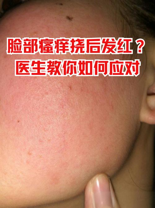 脸部干痒红,急救缓解与日常养护怎么做?