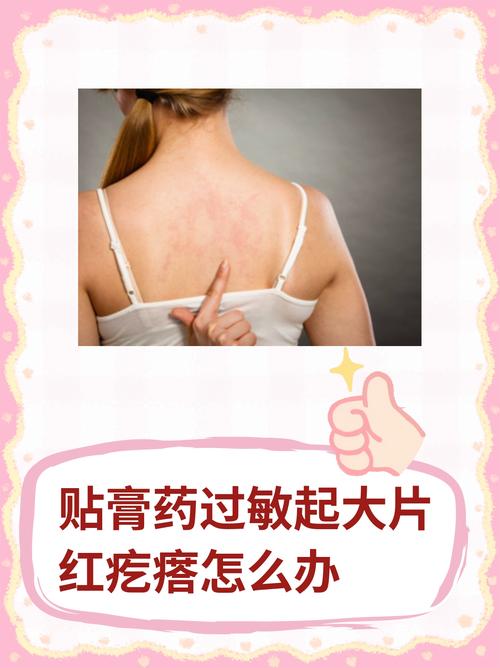 贴药膏后皮肤痒,是过敏还是正常反应?