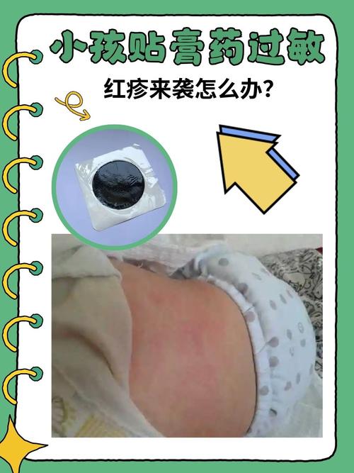 贴药膏后皮肤痒,是过敏还是正常反应?