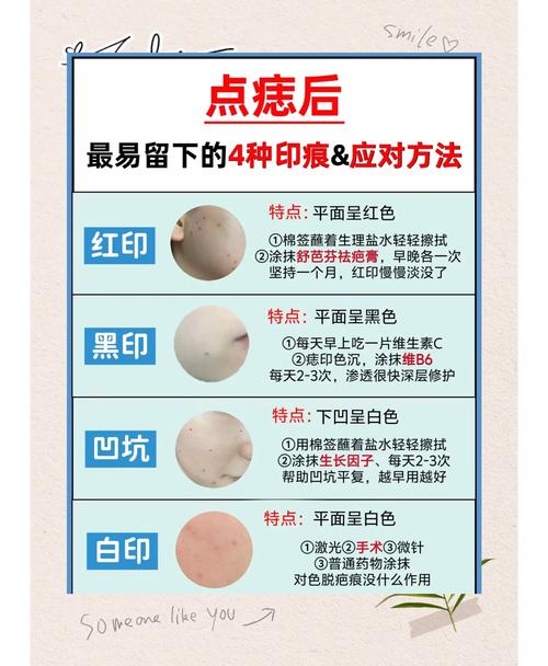 皮肤痣变大是危险信号吗?