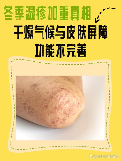 表面活性剂对皮肤危害到底有多大?