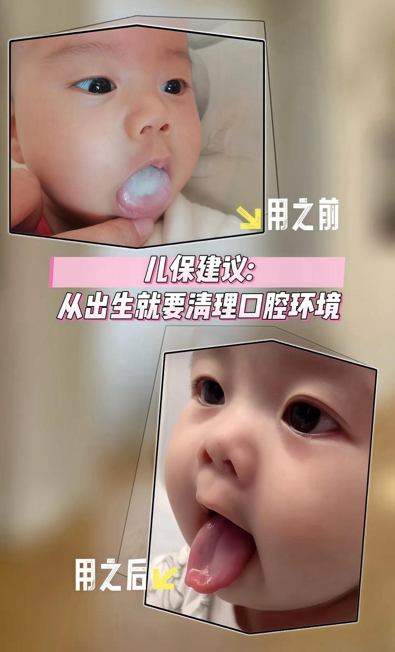 怎么给新生儿清理口腔