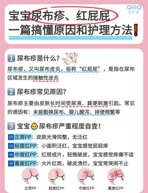 蜘蛛尿沾皮肤上该咋处理?