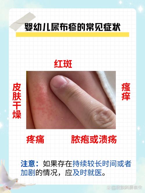 蜘蛛尿沾皮肤上该咋处理?