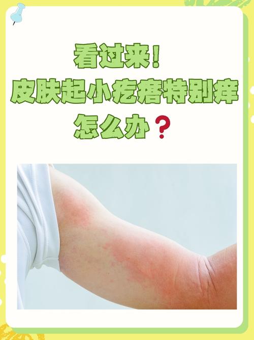 月子里皮肤痒是啥原因?