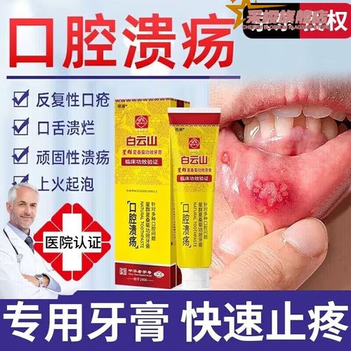 什么牙膏真能治口腔溃疡吗?