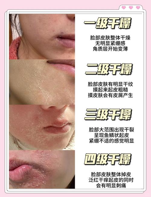 皮肤太干不吸收,如何快速打开吸收通道?