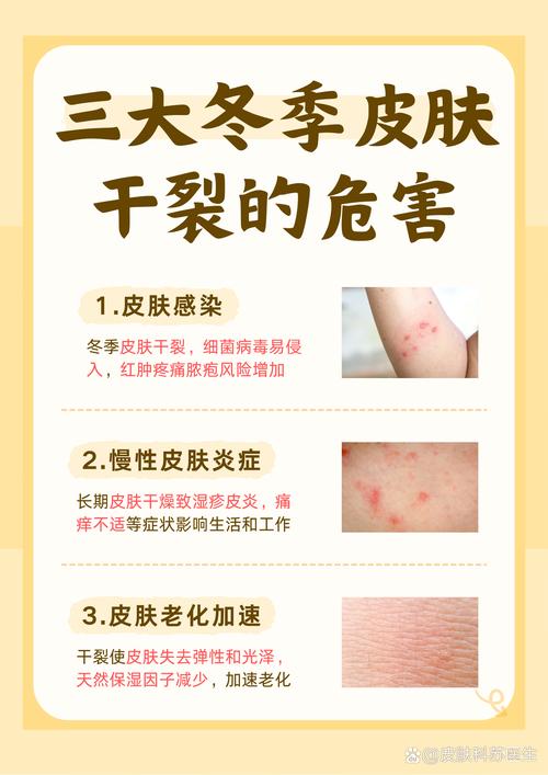 皮肤太干不吸收,如何快速打开吸收通道?