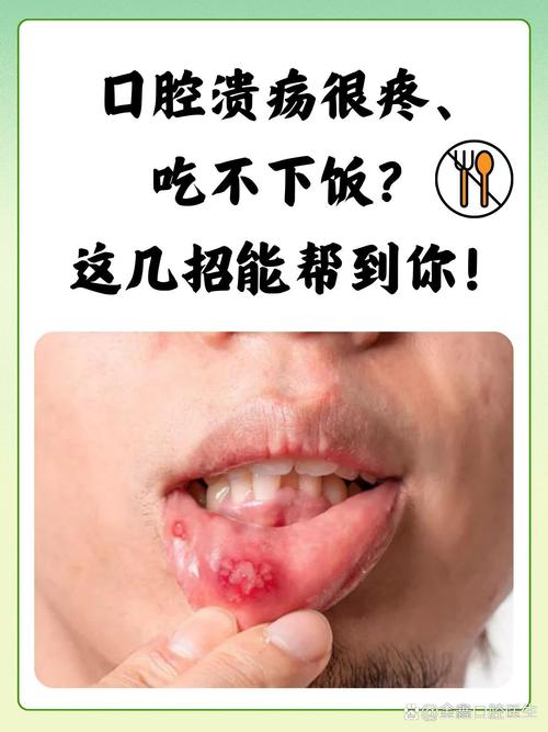 口腔溃疡土方法真的管用吗?