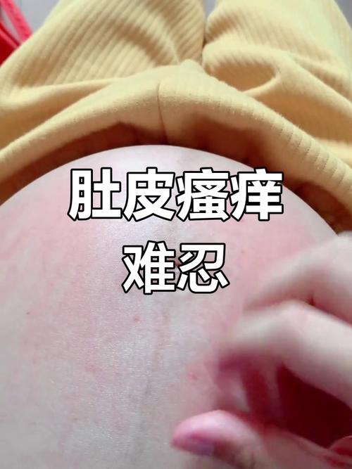 小腹皮肤痒,是过敏还是疾病信号?