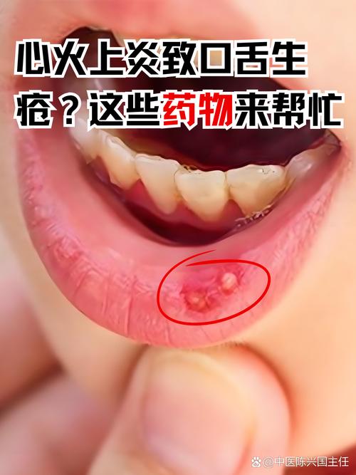 口腔为何总感觉有药味?