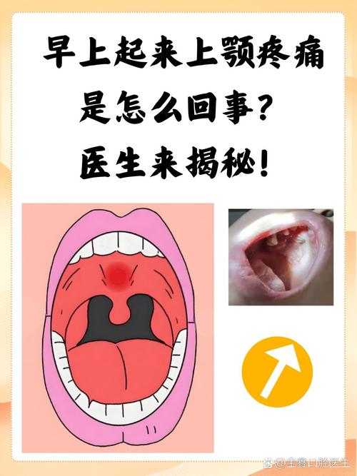 口腔内壁痒是怎么回事