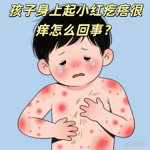 小孩皮肤起红疙瘩很痒怎么办?