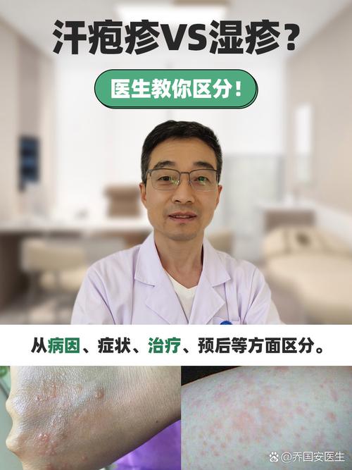 皮肤病中医还是西医好