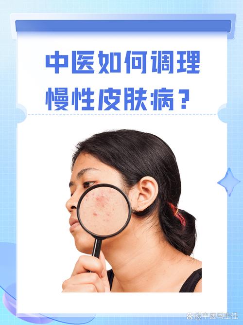 皮肤病中医还是西医好