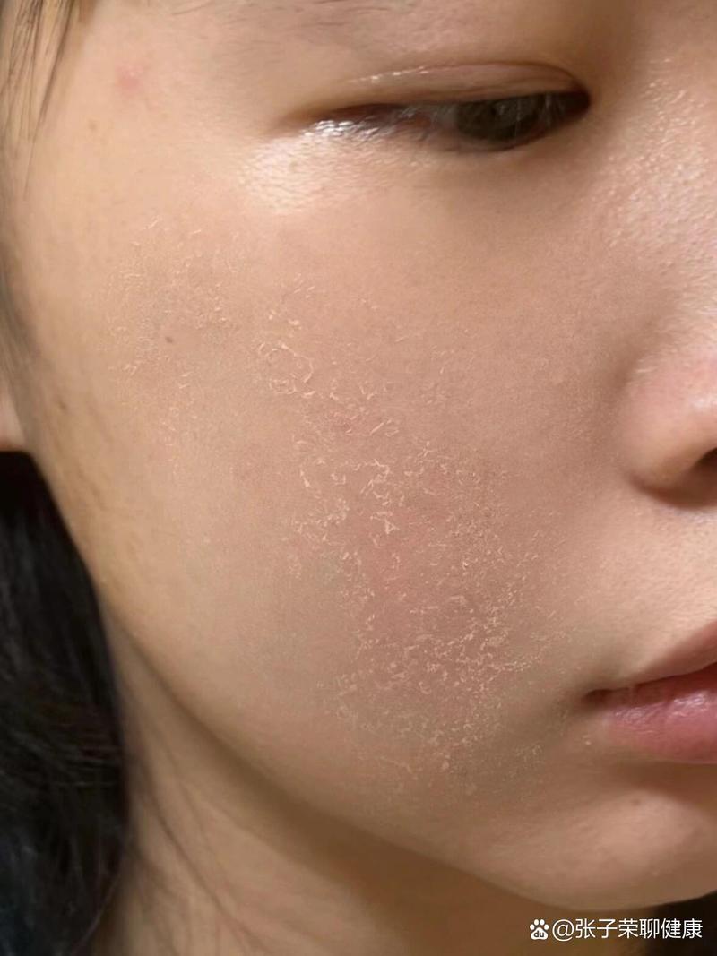 脸上皮肤为何突然变磨砂皮?